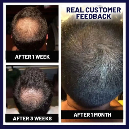 HZA™ Natural Hair Regrowth Spray