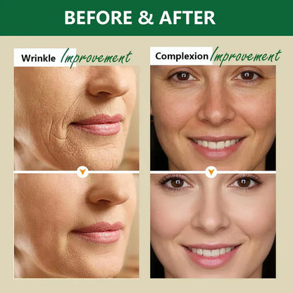 Aussie Betta Golden Micro-Peptide Tallow Serum-Gentle Anti-Aging for Sensitive Skin