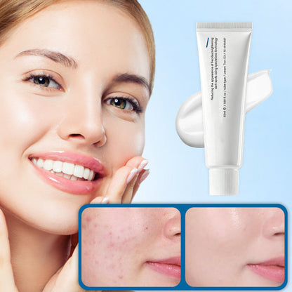 TX Tranexamic Acid Cream