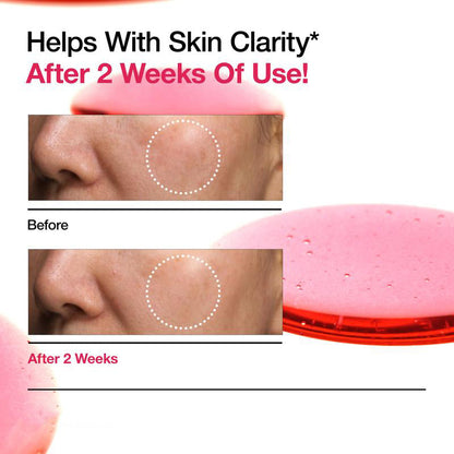 ANUA NIACINAMIDE 10% + TXA 4% DARK SPOT CORRECTING SERUM